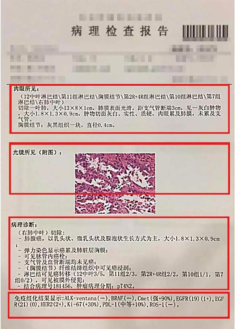 教你如何解读乳腺癌病理报告：医生教你怎样看懂乳腺癌细胞信息