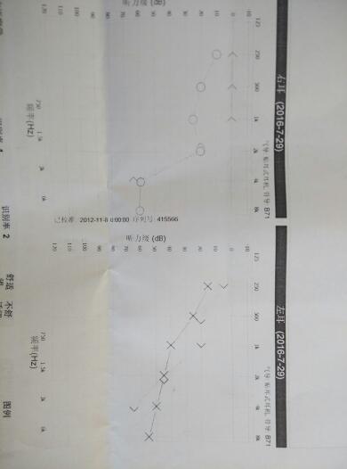 解读听力报告单：AI与AC、BC等缩写的含义及听力损失程度分析