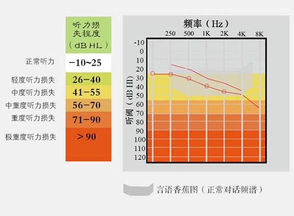 解读听力报告单：AI与AC、BC等缩写的含义及听力损失程度分析