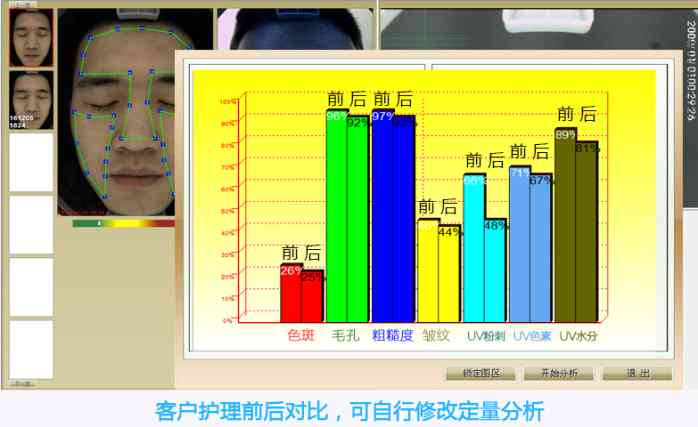 魔镜皮肤检测仪具体数据分析：解读报告与使用方法指南