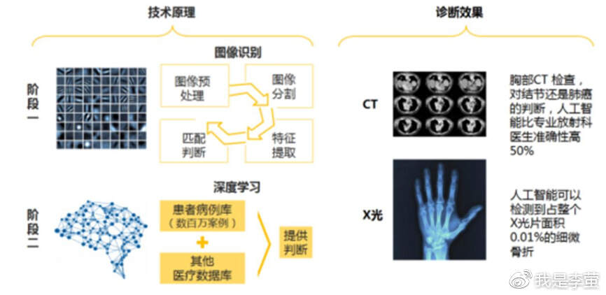 ai看医学检查报告怎么看