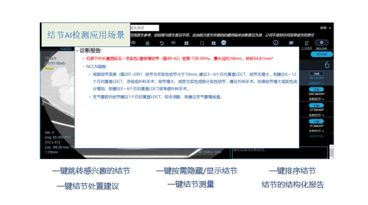 全面解析：影像AI诊断产品的功能、优势与应用前景