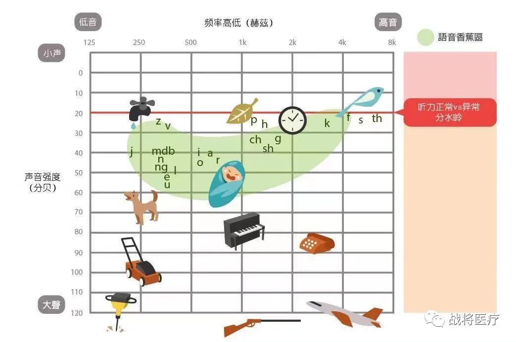 听力报告表ai是什么意思