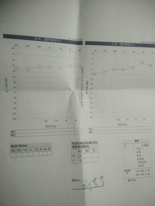 听力报告表ai是什么意思