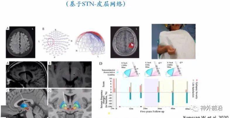 ai设置出血线的作用：如何设置内出血线与外出血线