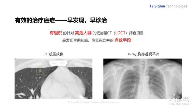 深度解读：肺部CT报告全解析，涵常见病症与潜在健风险