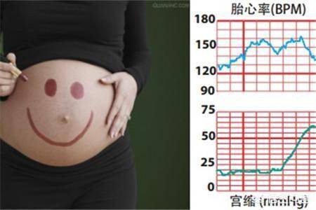 深入了解胎心监护ioco：孕期胎儿健监测新篇章