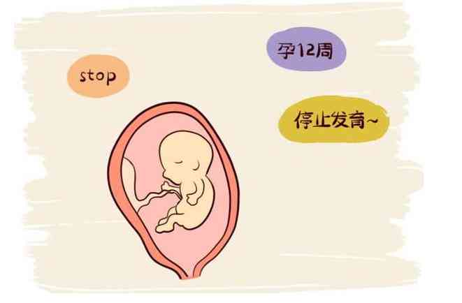 全面解读胎心监护仪数据：异常情况分析与孕期健管理指南