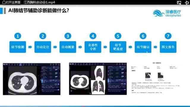 基于AI技术的医学影像诊断研究报告：方法、应用与效能分析