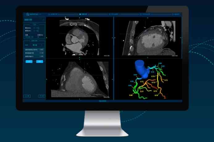 智能AI影像诊断系统：精准医疗新篇章