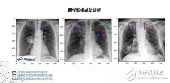 aip影像学：深入解析其在医学诊断中的应用与意义