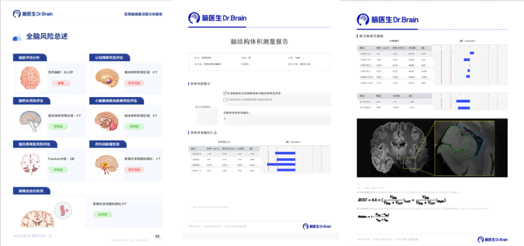 ai磁共振报告：解读与模板大全，包含报告单及检验报告样式