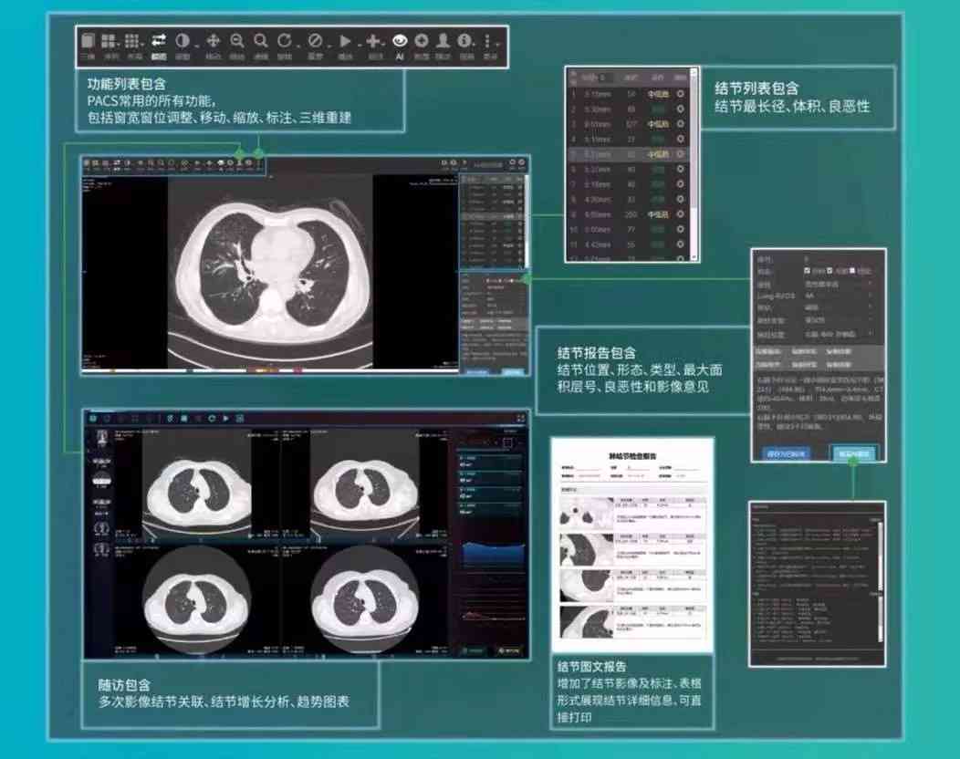 ai磁共振报告：解读与模板大全，包含报告单及检验报告样式