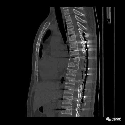 公众号文案写作技巧：全面教程与深度分析，掌握写作方法与实战技巧