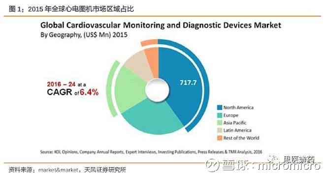 解读心电监测：AI智能报告深度解析