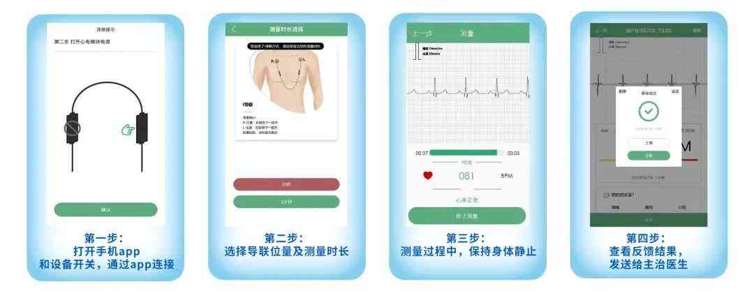 心电AI报告解读：全面解析心电图智能分析结果与常见疑问