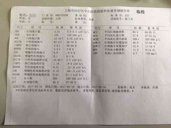 全面解读听力检测报告单数值：涵各项指标详解与常见问题解答