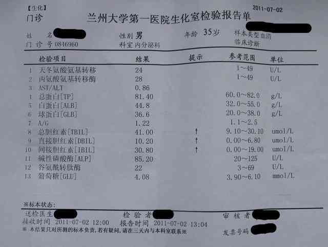 全面解读听力检测报告单数值：涵各项指标详解与常见问题解答