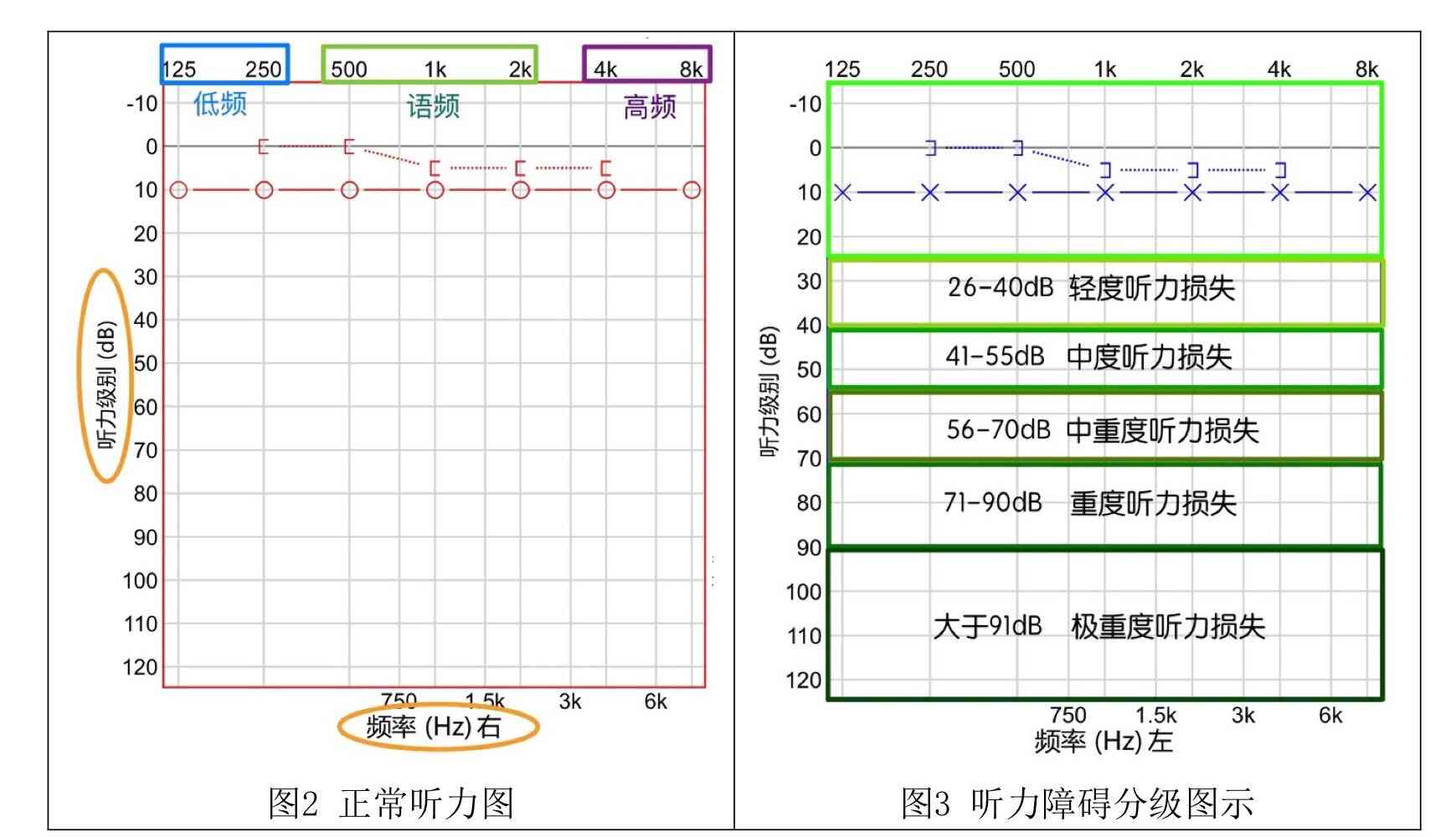 全面听力评估报告：解读听力检查结果与相关健建议