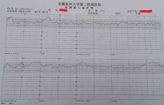 智能胎心监护：AI报告解读与生命安全保障