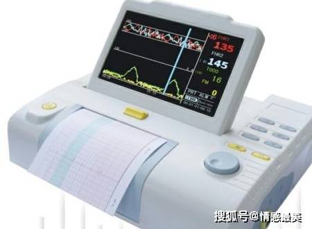 深入了解：胎心监护仪AI报告的解读与在母婴健管理中的应用