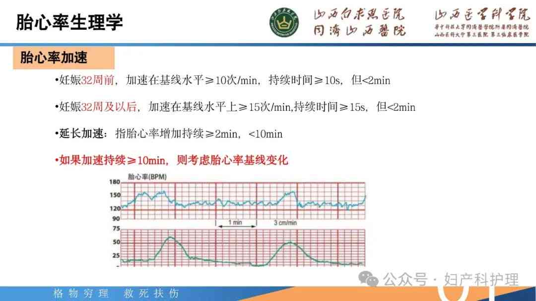 胎心监护ioco是什么：胎心监护e.uc、acceleration、ld、ltv的含义解析