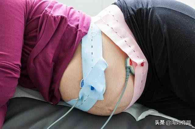 智能胎心监护仪：实时数据分析助力母婴健安全