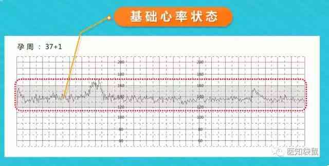 全面解读胎心监护报告：评价指标、图形分析、异常情况与应对策略