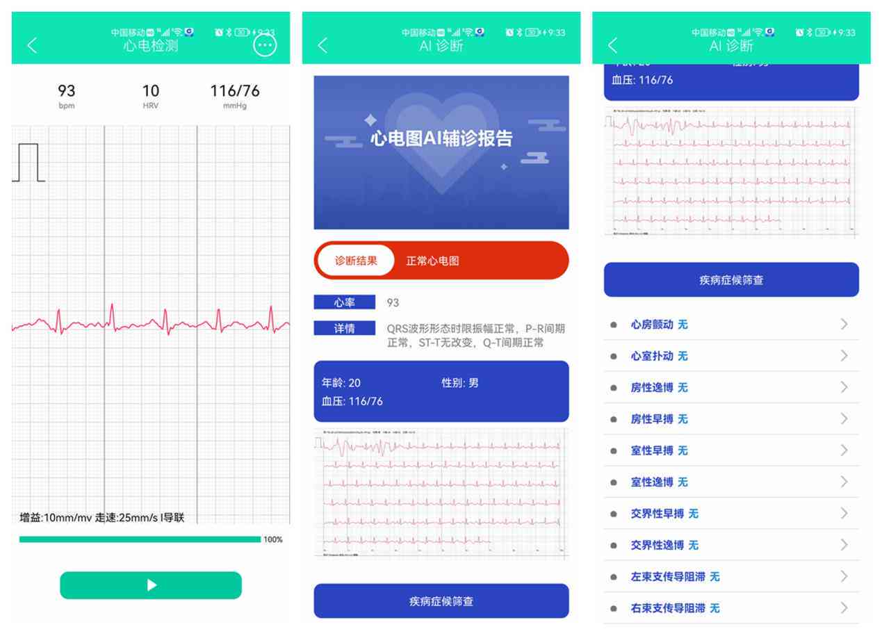 胎心监护仪ai报告是什么-胎心监护仪ai报告是什么意思啊