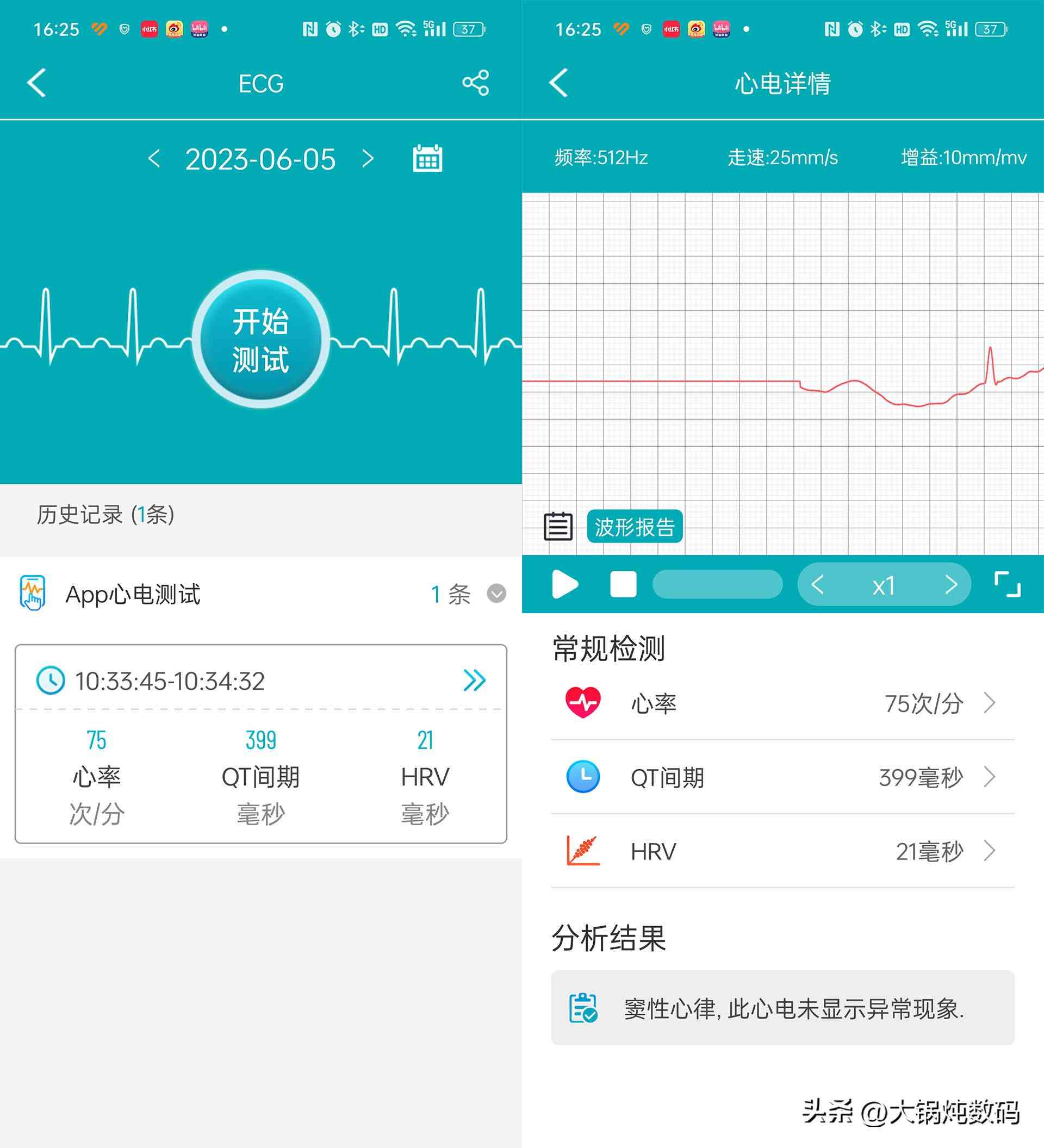 心电ai报告啥意思-心电ai报告啥意思啊